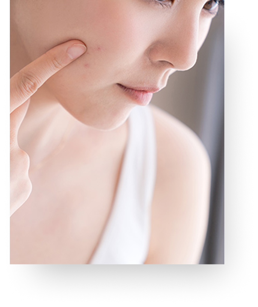 추천 타입 이미지 4